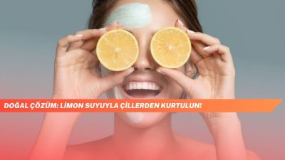 Doğal Çözüm: Limon Suyuyla Çillerden Kurtulun!