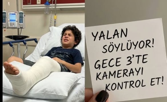Oğlumun bacağı kırıldıktan sonra ona bakmak için hastaneye gittim—sonra hemşire